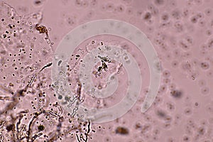 Microscope of black fungus spore strain with Lactophenol cotton red.