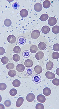Microscope image displaying numerous red blood