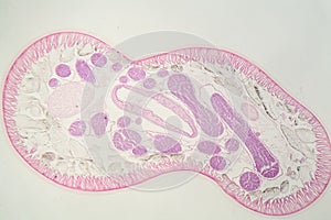 Parasitic nematode worm Ascaris sp. under the microscope