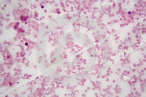 Microscope photo of human blood with Trypanosoma brucei a parasite responsible for African trypanosomiasis