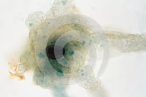 Microscope view of an amoeba photo