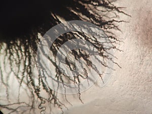 Microscope view of a Aureobasidium pullulans  fungalcolony