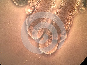 The beautiful fractal pattern of growth of bacteria on nutrient agar medium