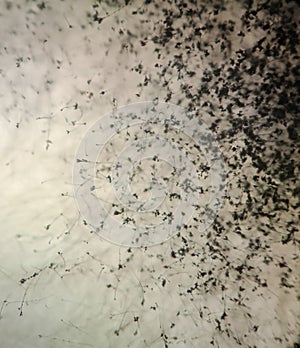 Aspergillus fumigatus under the microscope photo