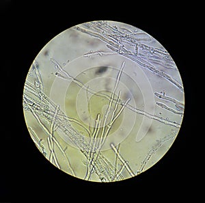 Microscope view of fungi mycelium filaments 40x increase