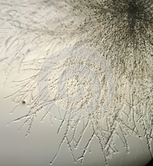 Fusarium oxysporum under the microscope
