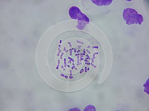 Human chromosomes under the microscope