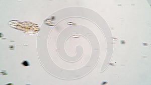 Microscopic animal rotifer in a drop of water from a pond under a microscope