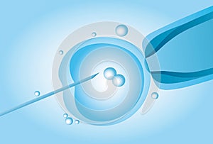 Microscopic artificial insemination, In vitro fertilisation IVF photo