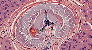 Microscopic Brain Inflammation: High-Resolution Histological Image of Neural Tissue Showing Inflammation photo