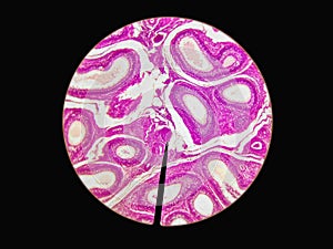 Microscopic cross section of testes testis T.S tissue photo