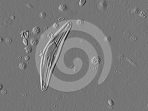 Microscopic Diatom