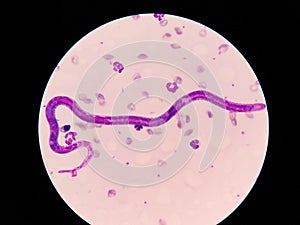 Microscopic examination of stained blood films used to differentiate microfilariae.