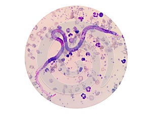 Microscopic examination of stained blood films used to differentiate microfilariae.