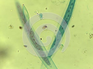 Microscopic Field of Crescent-Shaped Green Algae (Closterium) Filament