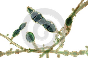 Microscopic fungi Microsporum audouinii, 3D illustration