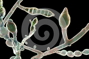 Microscopic fungi Microsporum audouinii, 3D illustration