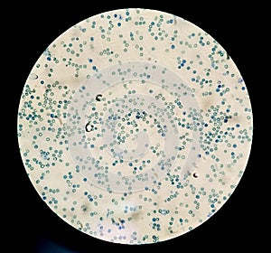 Microscopic image of abnormal high reticulocytes count . Nucleated RBC or nRBC test at medical laboratory. photo