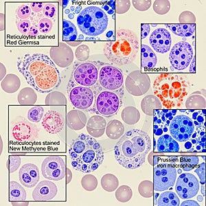 Microscopic image displays various blood cells