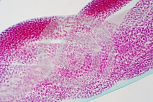 Microscopic image of the eggs parasite Toxocara canis under t