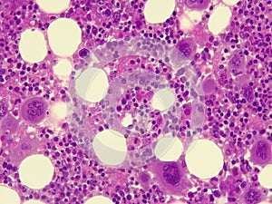 Microscopic image of human bone marrow 400x photo