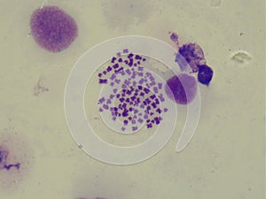 Microscopic image of human chromosomes 1000x photo