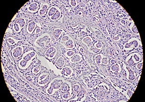 Microscopic image of kidney tissue displaying