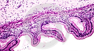 Microscopic image showing epithelium of urinary bladder