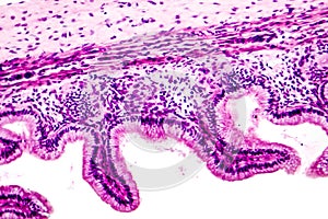 Microscopic image showing epithelium of urinary bladder
