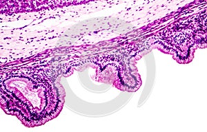 Microscopic image showing epithelium of urinary bladder