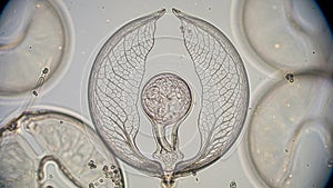 Its intricate cilia arranged in a wheel like structure for locomotion