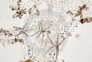Microscopic life, spiked algae hedgehog, probably diatom algae. Freshwater phytoplankton by microscope photo