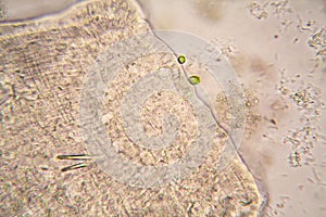 Microscopic organisms from the pond water. Nematode