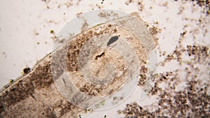 Microscopic organisms from the pond water. Nematode photo