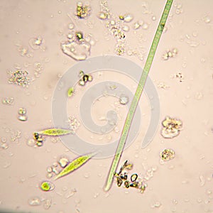 Oscillatoria simplicissima and Euglena Gracilis photo
