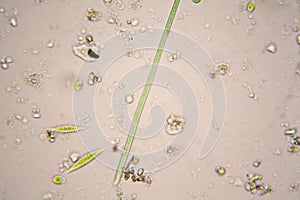 Oscillatoria simplicissima and Euglena Gracilis photo