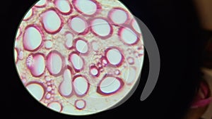 Microscopic photo of xylem in beet root permanent preparation