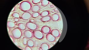 Microscopic photo of xylem in beet root permanent preparation