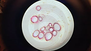 Microscopic photo of xylem in beet root permanent preparation
