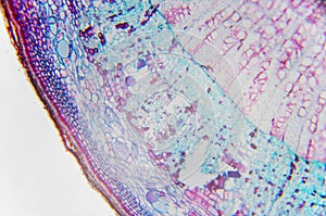 Microscopic photography. Core of a Stem of Xylophyta dicotyledon photo