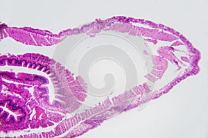 Microscopic photography. Earthworm, transversal section.