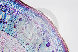 Microscopic photography. Stem of Xylophyta dicotyledon, transversal section. photo