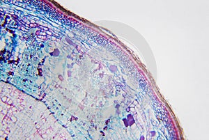 Microscopic photography. Stem of Xylophyta dicotyledon, transversal section.