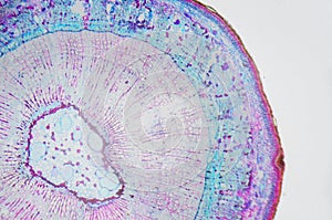 Microscopic photography. Stem of Xylophyta dicotyledon, transversal section.