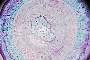 Microscopic photography. Young Root of plant, transversal section.