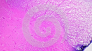 Microscopic Prepartion Spinal cord cell TS 100x magnification coloured by pink