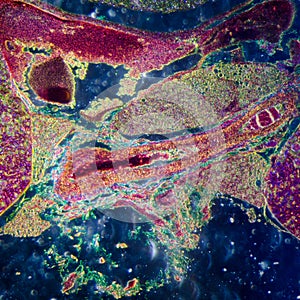 Microscopic section of human kidney