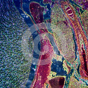 Microscopic section of human kidney