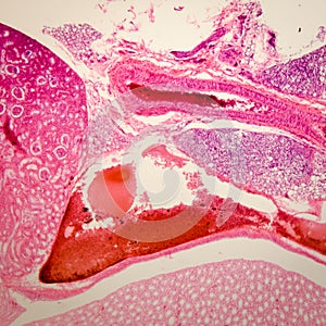 Microscopic section o kidney