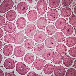 Microscopic section of Testis T.S